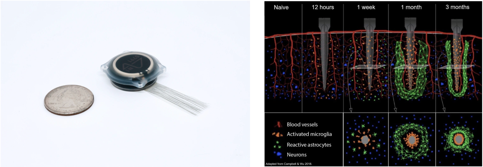 图片[14]-马斯克「脑机第一人」首爆！不开颅在线升级，永生代码已写入-AI Express News