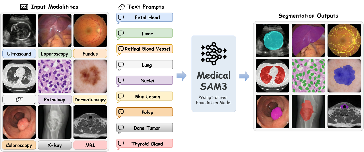 图片[4]-告别「手动画框」！Medical SAM3：首个真正「纯文本提示」驱动的医学全能分割模型-AI Express News
