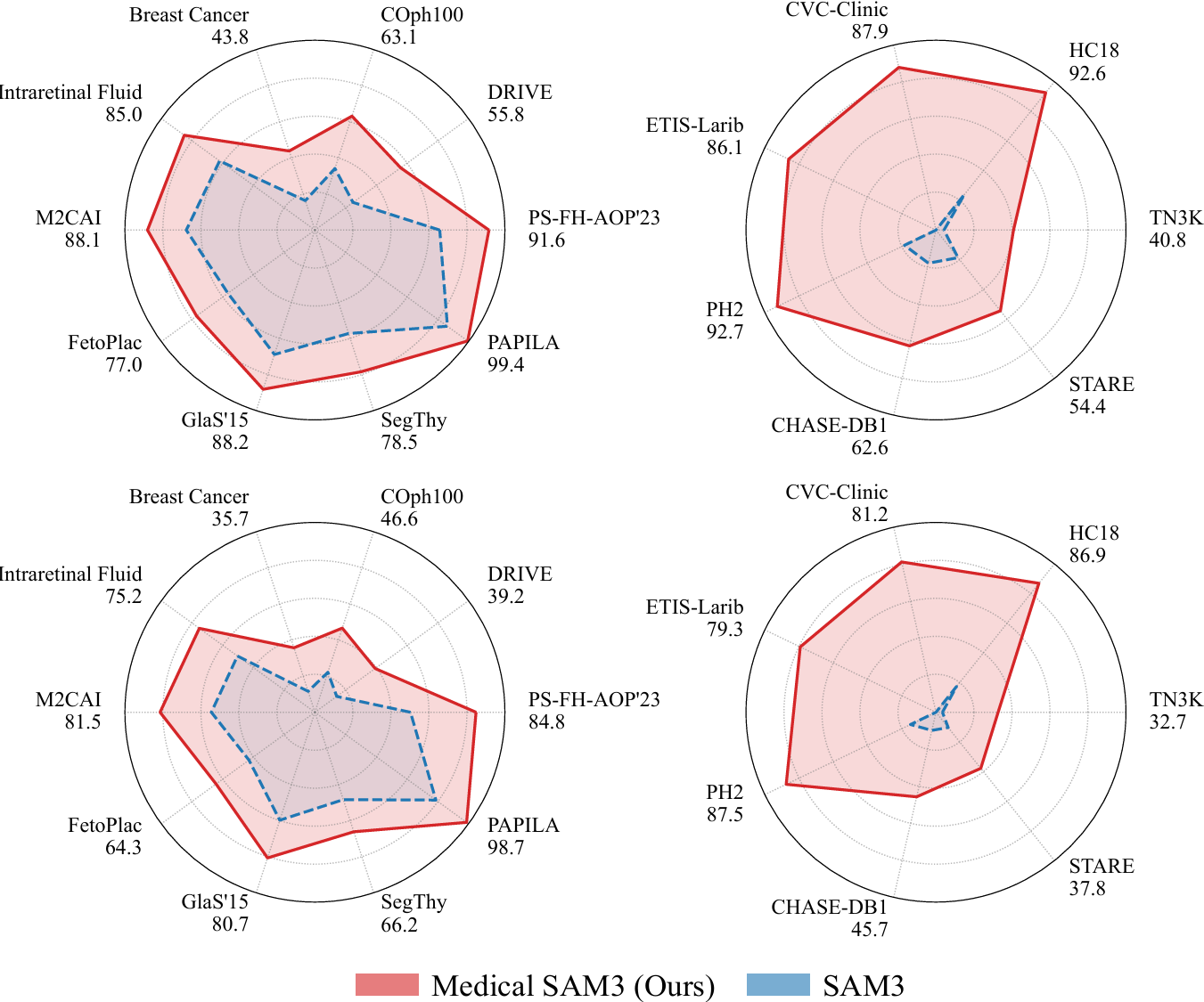 图片[5]-告别「手动画框」！Medical SAM3：首个真正「纯文本提示」驱动的医学全能分割模型-AI Express News