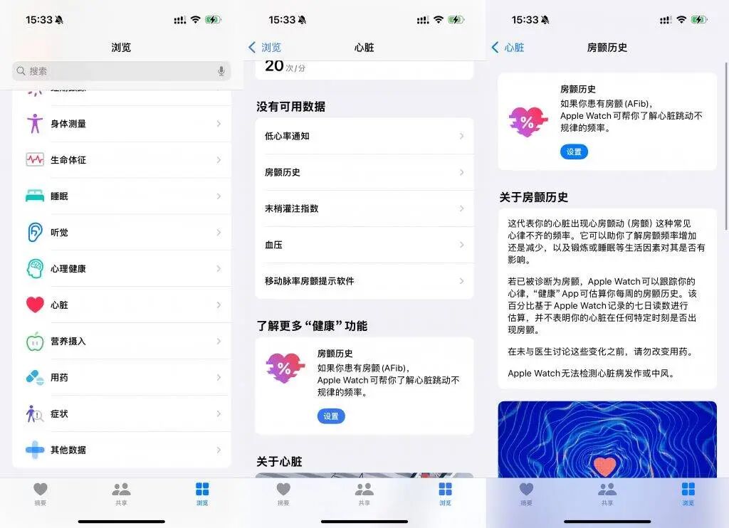 图片[2]-专访苹果医学家：房颤患者，为什么应该戴一块 Apple Watch？-AI Express News